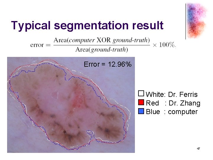Typical segmentation result Error = 12. 96% White: Dr. Ferris Red : Dr. Zhang