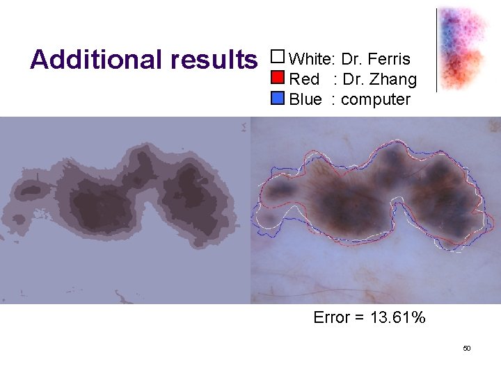 Additional results White: Dr. Ferris Red : Dr. Zhang Blue : computer Error =