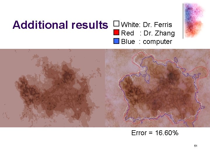 Additional results White: Dr. Ferris Red : Dr. Zhang Blue : computer Error =