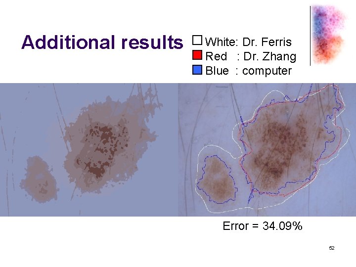 Additional results White: Dr. Ferris Red : Dr. Zhang Blue : computer Error =