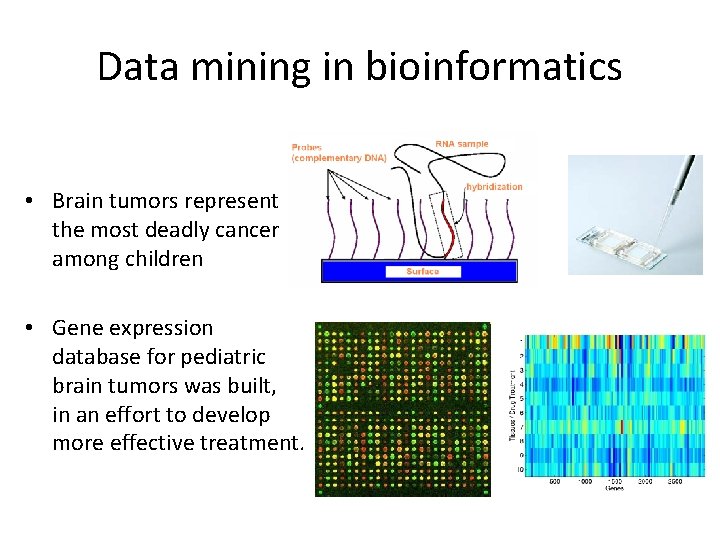 Data mining in bioinformatics • Brain tumors represent the most deadly cancer among children