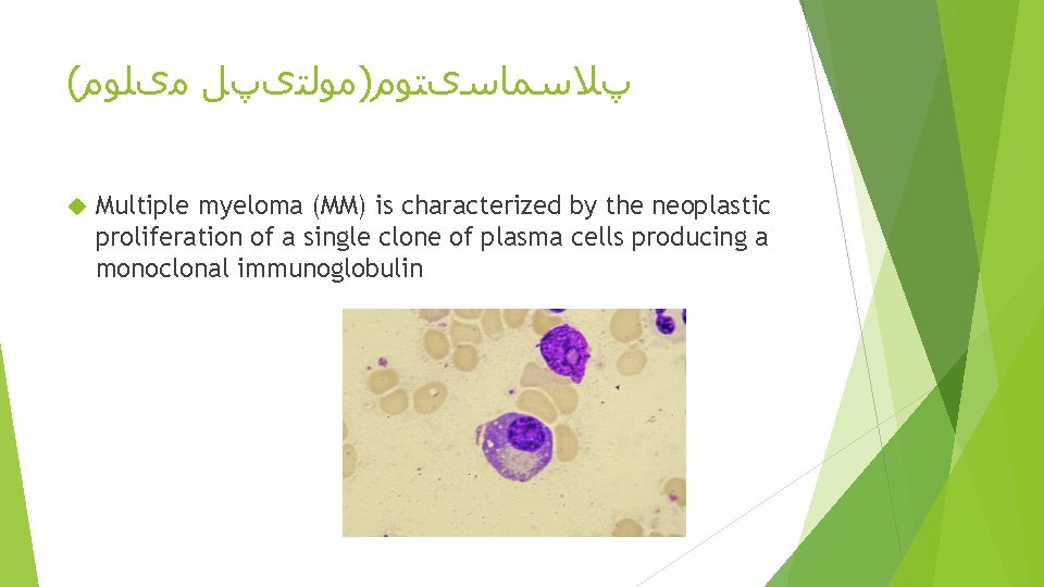 ( پﻼﺳﻤﺎﺳیﺘﻮﻡ)ﻣﻮﻟﺘیپﻞ ﻣیﻠﻮﻡ Multiple myeloma (MM) is characterized by the neoplastic proliferation of a