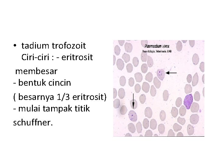  • tadium trofozoit Ciri-ciri : - eritrosit membesar - bentuk cincin ( besarnya