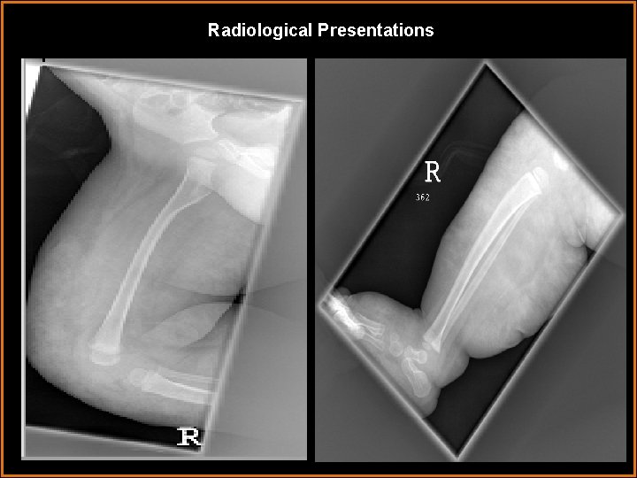 Radiological Presentations Radiological Presentations