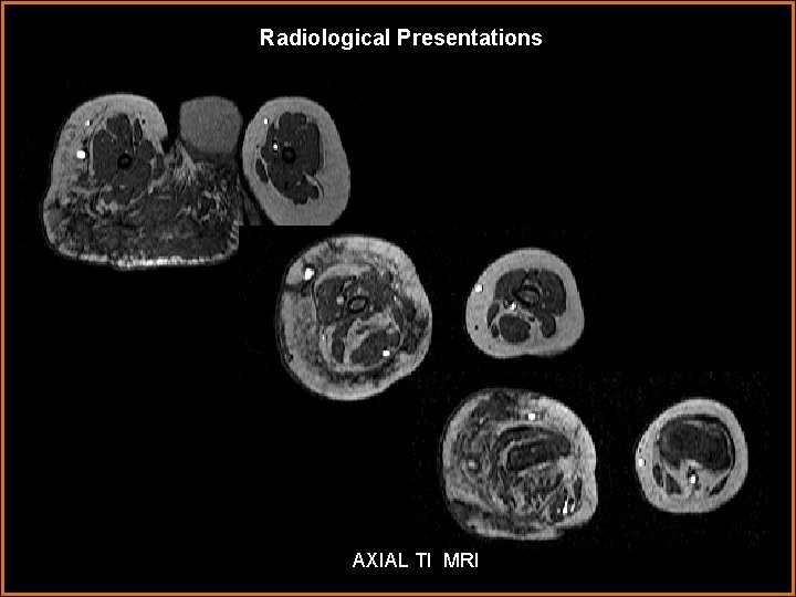 Radiological Presentations AXIAL TI MRI 