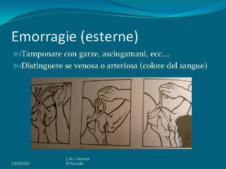 Emorragie (esterne) Tamponare con garze, asciugamani, ecc…. Distinguere se venosa o arteriosa (colore del