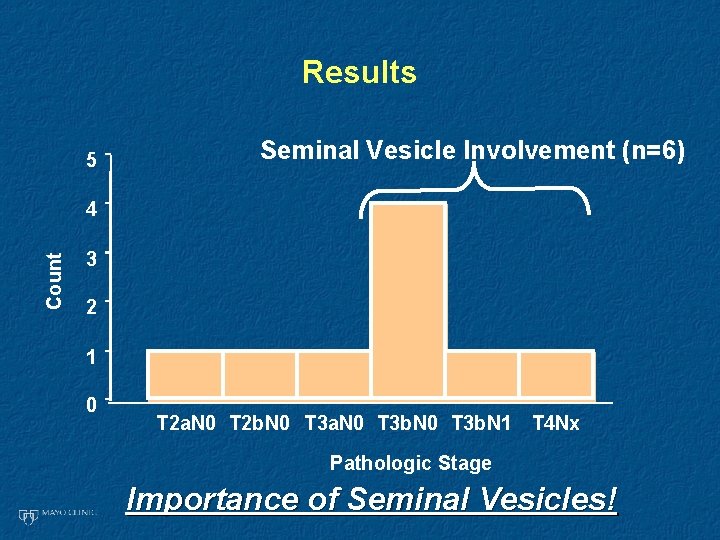 Results 5 Seminal Vesicle Involvement (n=6) Count 4 3 2 1 0 T 2
