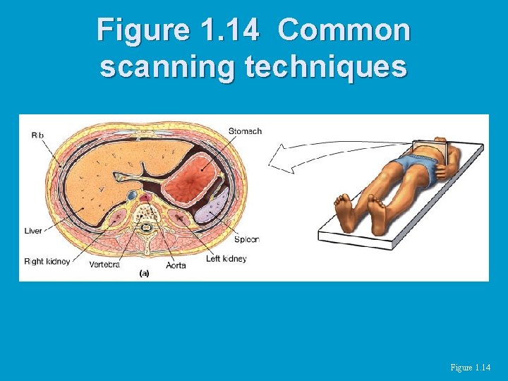 Figure 1. 14 Common scanning techniques Figure 1. 14 Figure 1. 14 Common scanning techniques Figure 1. 14