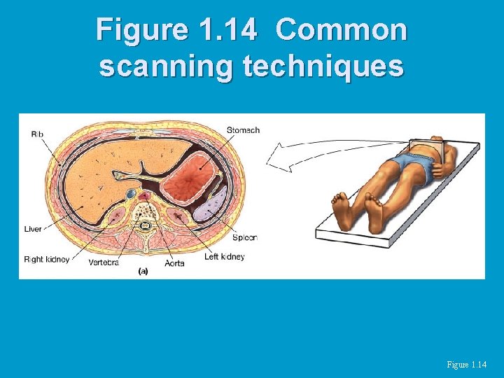 Figure 1. 14 Common scanning techniques Figure 1. 14 