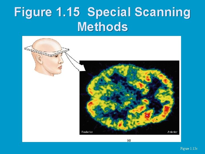 Figure 1. 15 Special Scanning Methods Figure 1. 15 c 