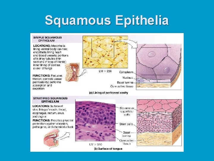 Squamous Epithelia 