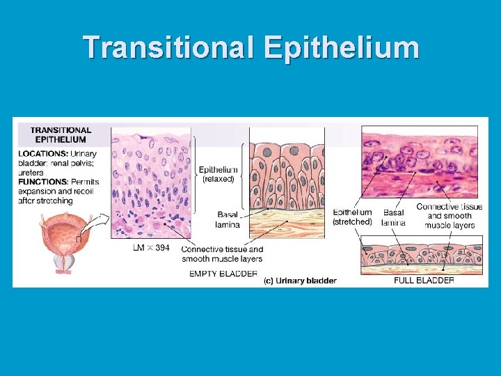 Transitional Epithelium 