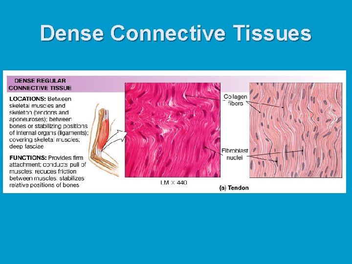 Dense Connective Tissues Dense Connective Tissues