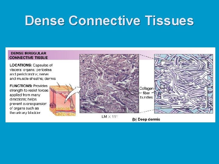 Dense Connective Tissues Dense Connective Tissues