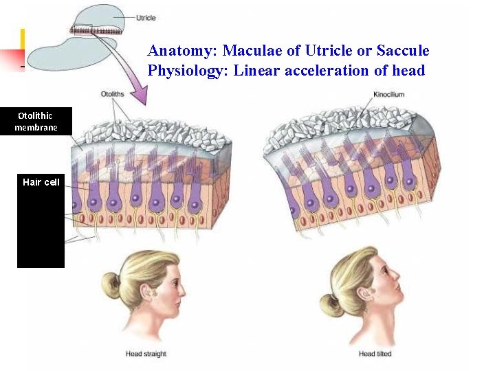 Anatomy: Maculae of Utricle or Saccule Physiology: Linear acceleration of head Otolithic membrane Hair