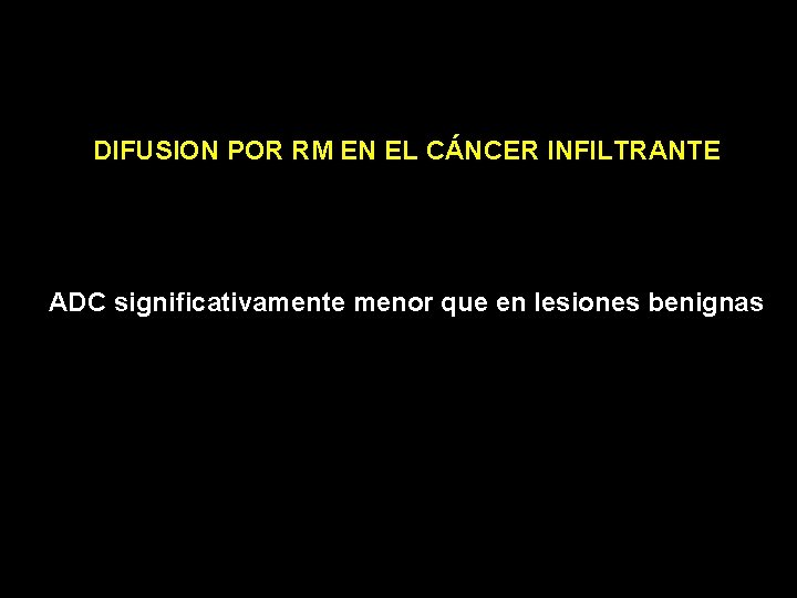 DIFUSION POR RM EN EL CÁNCER INFILTRANTE ADC significativamente menor que en lesiones benignas