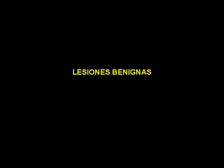 LESIONES BENIGNAS 