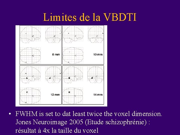 Limites de la VBDTI • FWHM is set to dat least twice the voxel