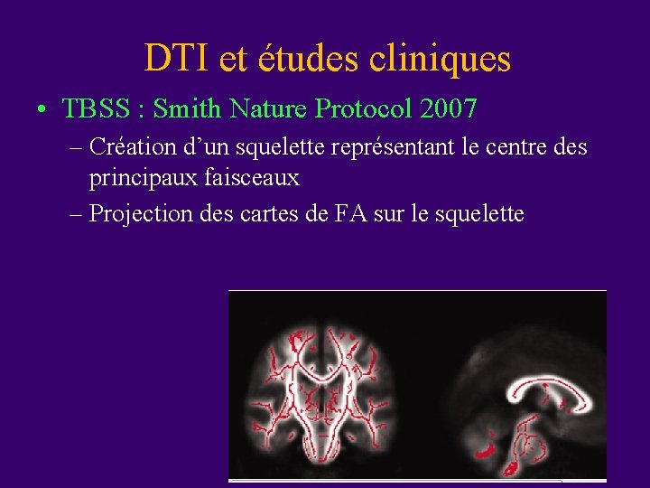 DTI et études cliniques • TBSS : Smith Nature Protocol 2007 – Création d’un