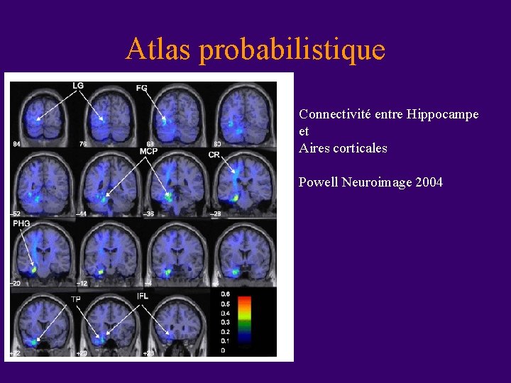 Atlas probabilistique Connectivité entre Hippocampe et Aires corticales Powell Neuroimage 2004 