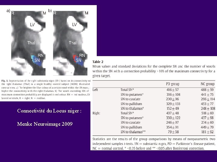 Connectivité du Locus niger : Menke Neuroimage 2009 