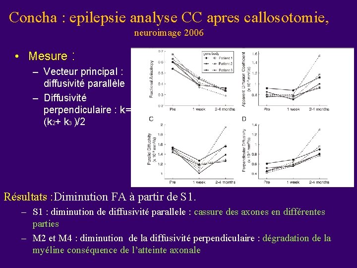 Concha : epilepsie analyse CC apres callosotomie, neuroimage 2006 • Mesure : – Vecteur