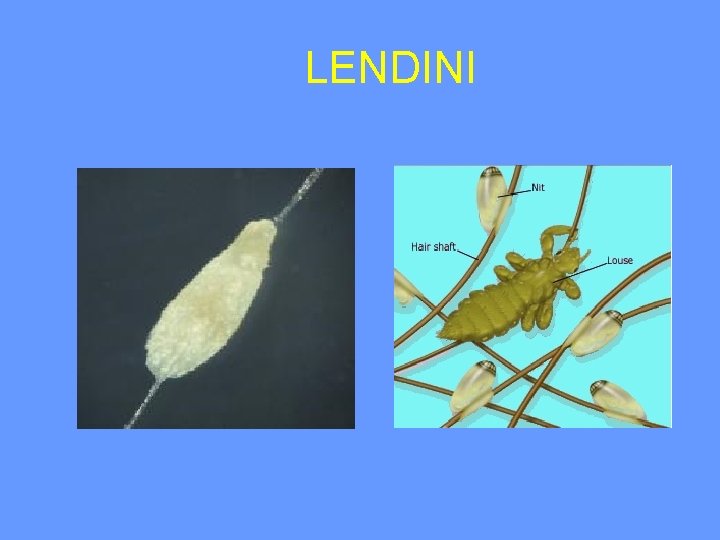 LENDINI 