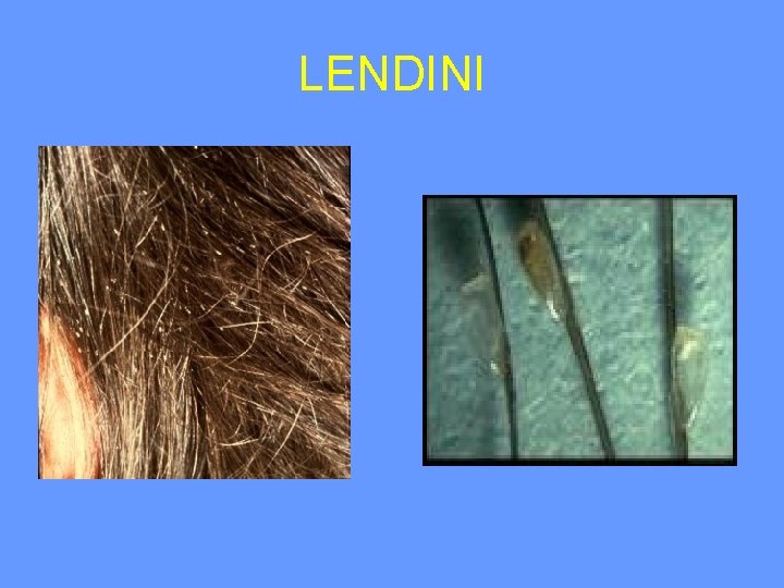 LENDINI 