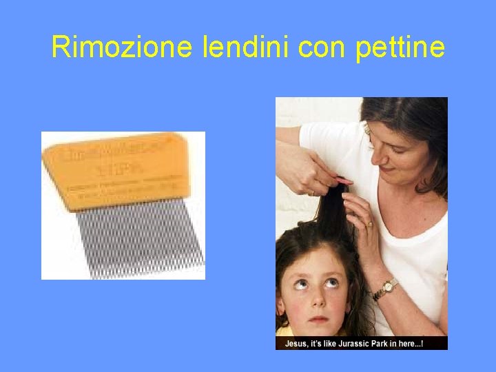 Rimozione lendini con pettine 