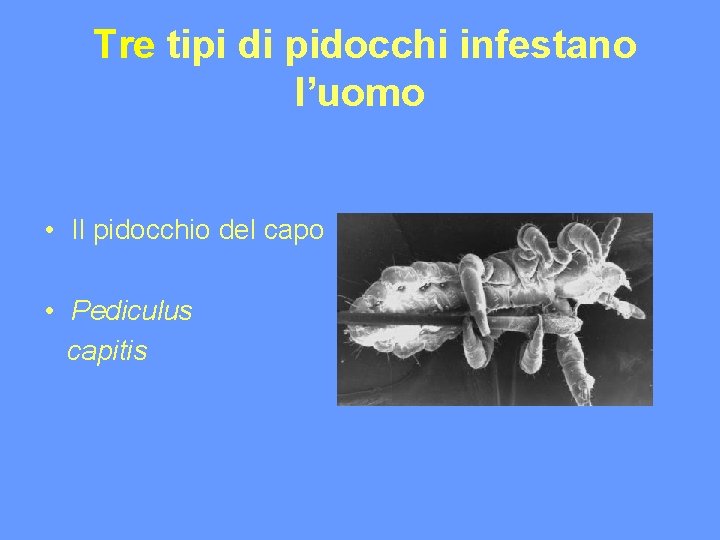 Tre tipi di pidocchi infestano l’uomo • Il pidocchio del capo • Pediculus capitis