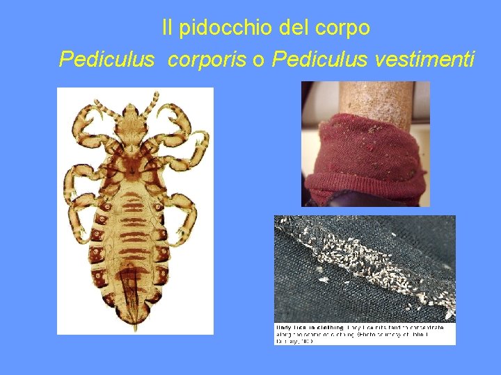 Il pidocchio del corpo Pediculus corporis o Pediculus vestimenti 