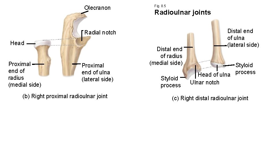 Olecranon Fig. 8. 5 Radioulnar joints Radial notch Head Proximal end of radius (medial