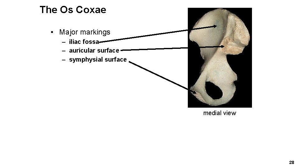 The Os Coxae • Major markings – iliac fossa – auricular surface – symphysial