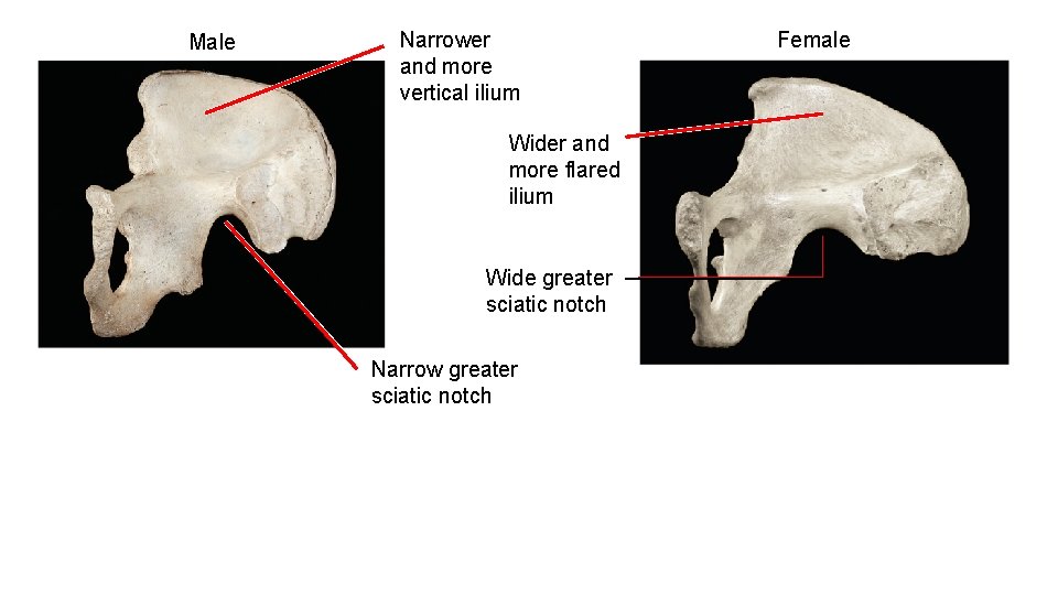 Male Narrower and more vertical ilium Wider and more flared ilium Wide greater sciatic
