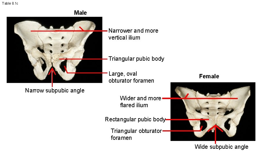 Table 8. 1 c Male Narrower and more vertical ilium Triangular pubic body Large,
