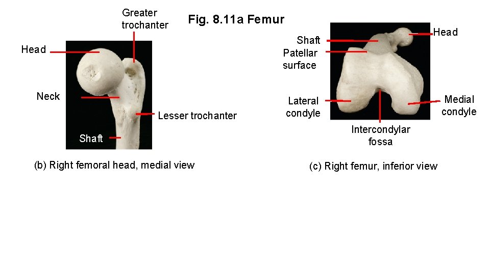 Greater trochanter Fig. 8. 11 a Femur Head Shaft Patellar surface Head Neck Lesser