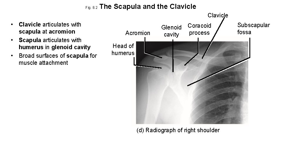 Fig. 8. 2 The Scapula and the Clavicle • Clavicle articulates with scapula at