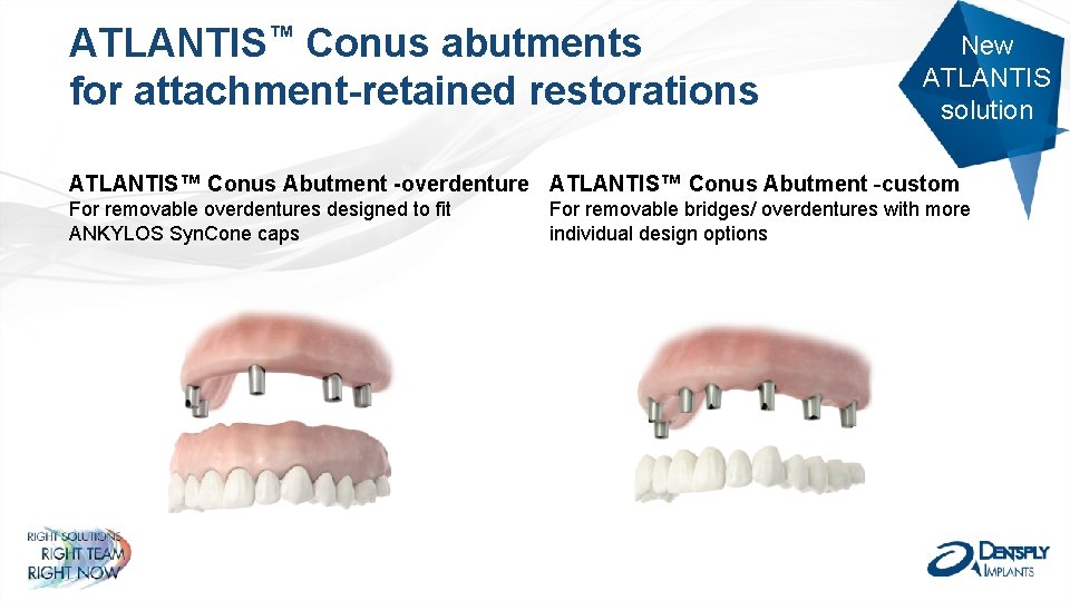 ATLANTIS™ Conus abutments for attachment-retained restorations New ATLANTIS solution ATLANTIS™ Conus Abutment -overdenture ATLANTIS™