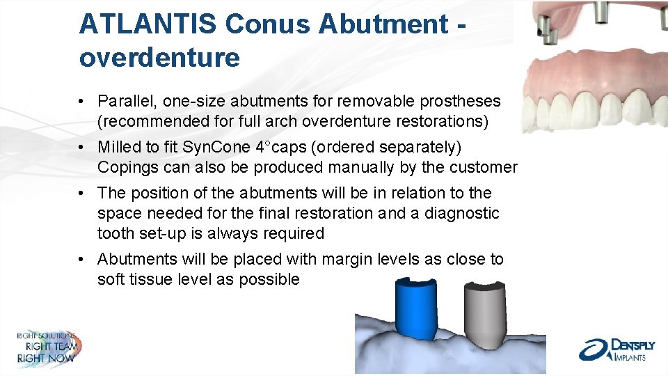 ATLANTIS Conus Abutment overdenture • Parallel, one-size abutments for removable prostheses (recommended for full