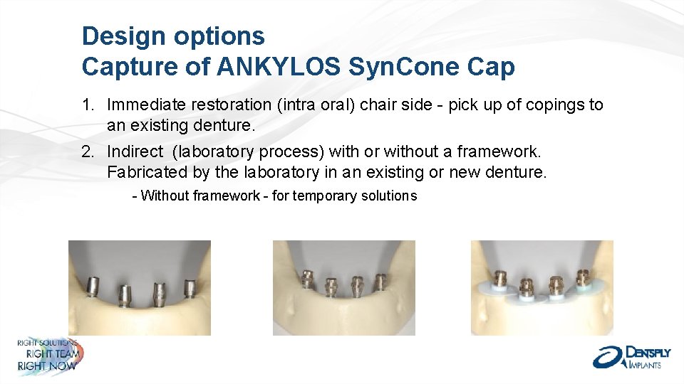 Design options Capture of ANKYLOS Syn. Cone Cap 1. Immediate restoration (intra oral) chair