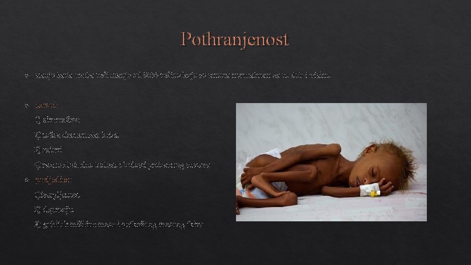 Pothranjenost stanje kada osoba teži manje od 85% težine koja se smatra normalnom za