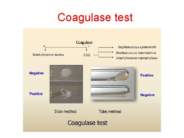 Coagulase test 