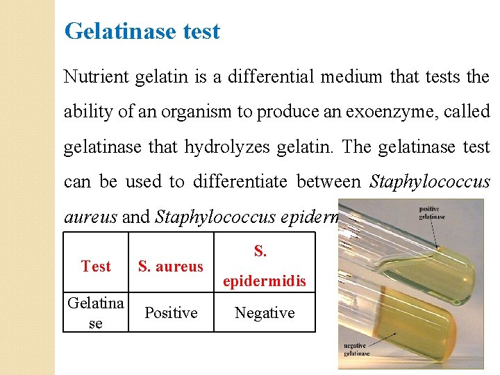 Gelatinase test Nutrient gelatin is a differential medium that tests the ability of an