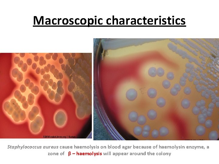 Macroscopic characteristics Staphylococcus aureus cause haemolysis on blood agar because of haemolysin enzyme, a