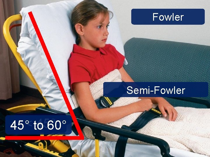 Fowler Semi-Fowler 45°< to 60° 