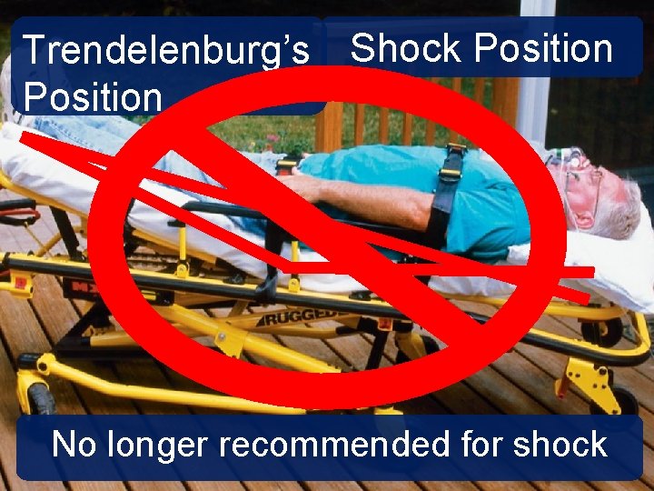Trendelenburg’s Shock Position No longer recommended for shock 