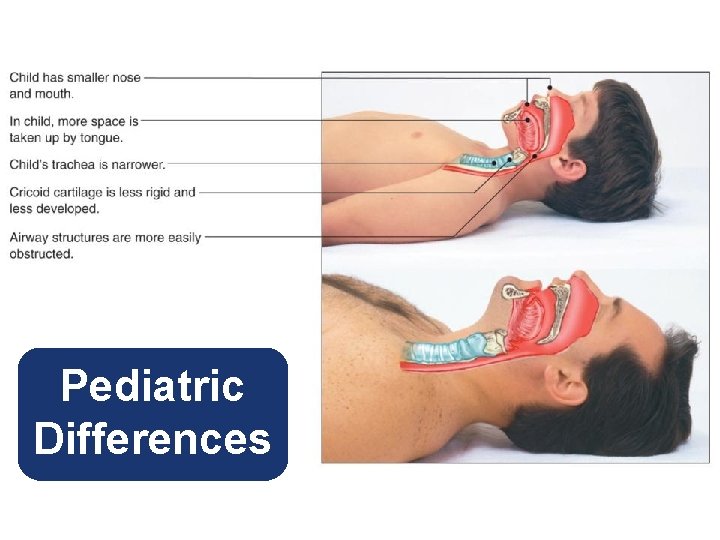 Pediatric Differences 