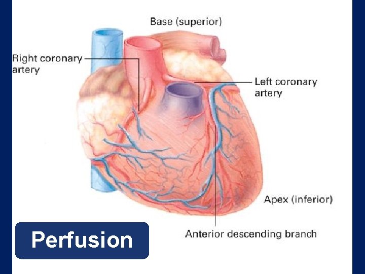 Perfusion 