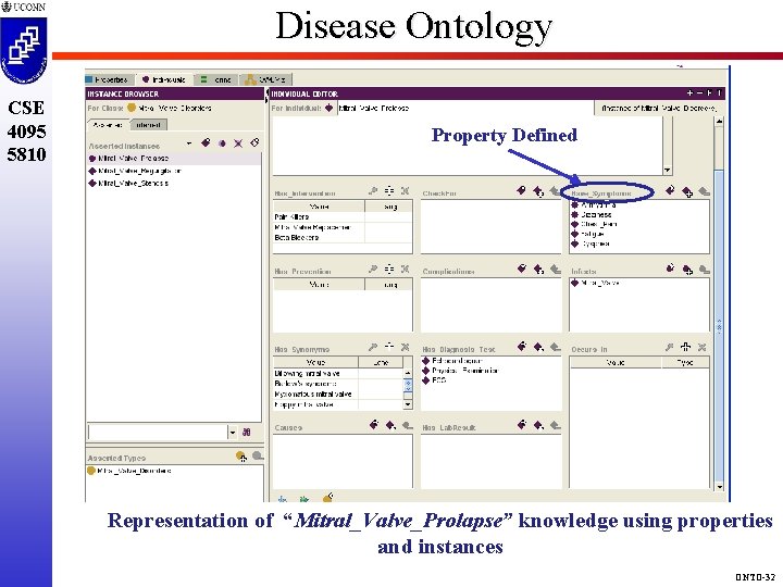 Disease Ontology CSE 4095 5810 Property Defined Representation of “Mitral_Valve_Prolapse” knowledge using properties and