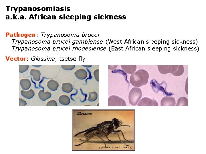 Trypanosomiasis a. k. a. African sleeping sickness Pathogen: Trypanosoma brucei gambiense (West African sleeping